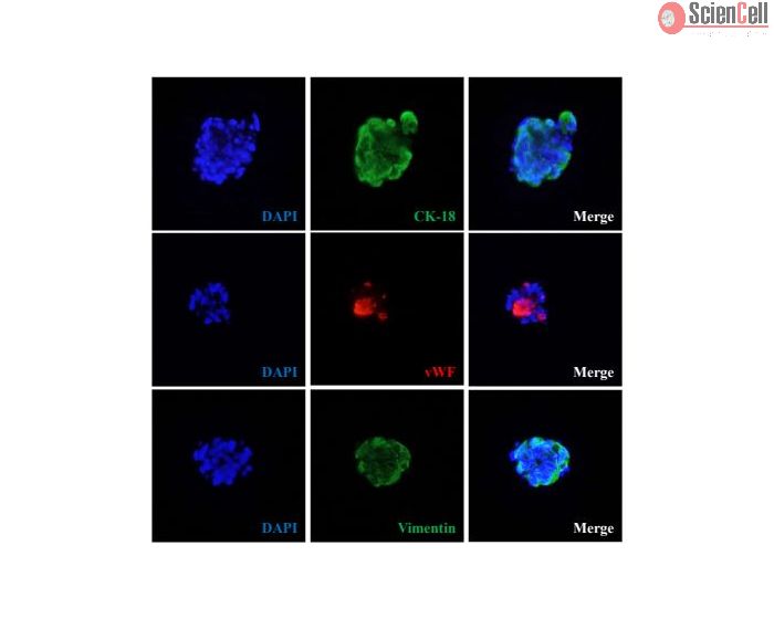 Human mini liver spheroids express hepatocyte marker cytokeratin 18 (CK-18), stellate cell marker vimentin and sinusoidal endothelial cell marker von Willebrand factor (vWF). 