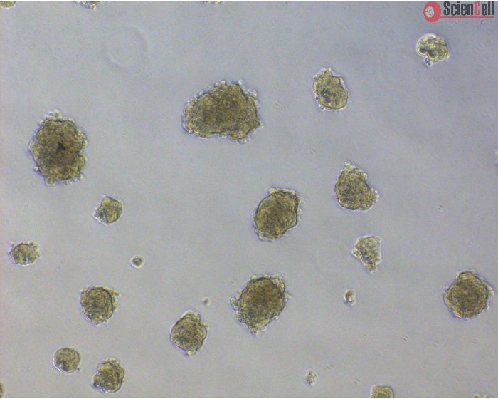 Human Ovarian Fibroblast Spheroids