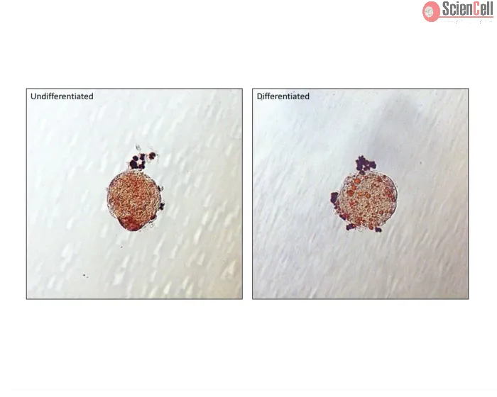 Lipid droplets are visible in Human Preadipocyte spheroids after 5 days of culture in differentiation medium