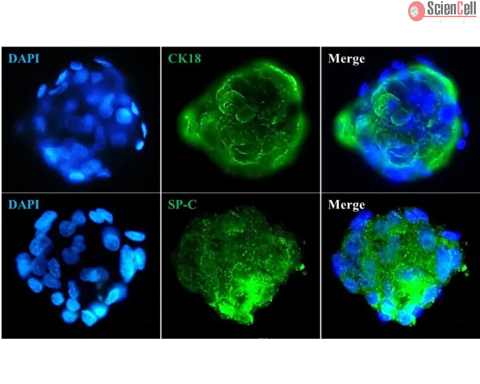 Immunostaining of the human pulmonary alveolar epithelial cell spheroids with the epithelial cell marker CK18 and the specific alveolar epithelial cell type II marker SP-C. 