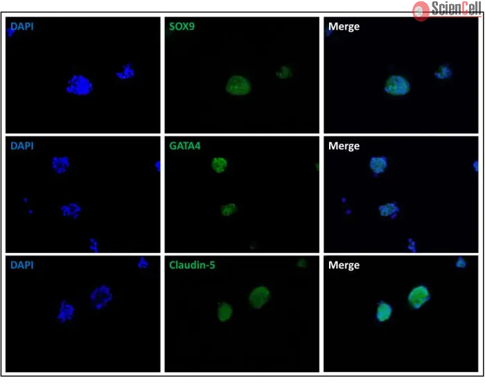 Immunostaining of the human Sertoli cell spheroids with the Sertoli cell markers SOX9 and GATA4 and tight junction marker Claudin-5.