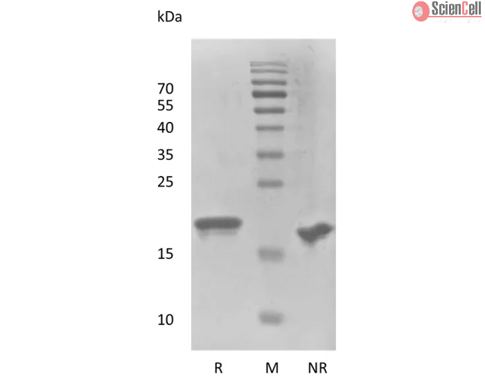 Recombinant Human Fibroblast Growth Factor-21 Thermostable