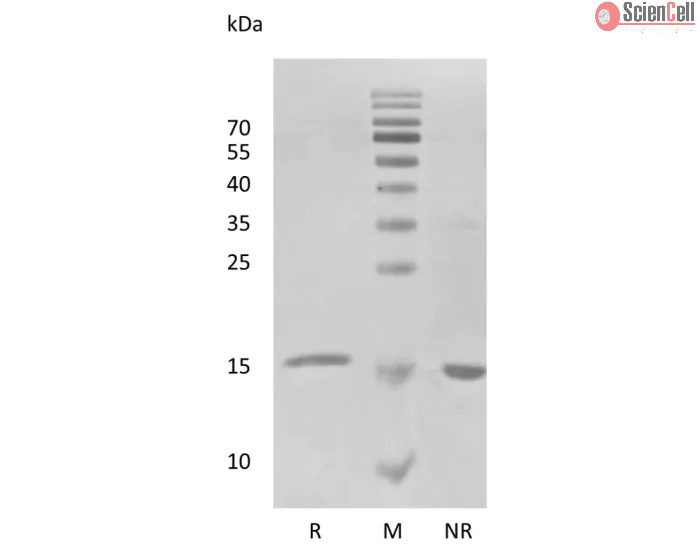 Recombinant Human Interferon-alpha2a