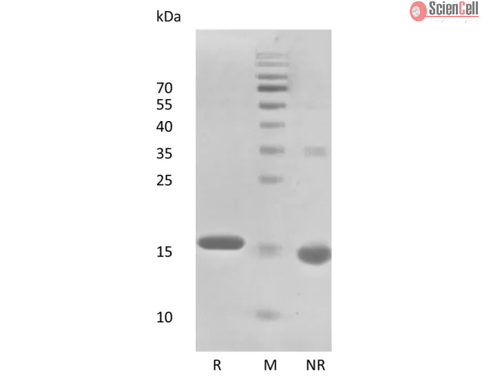 Recombinant Human Interferon-alpha2b 