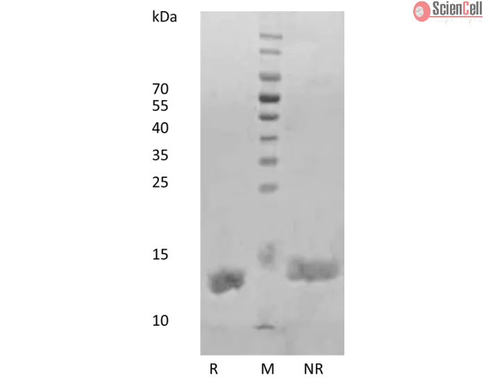 Recombinant Human Interleukin-2