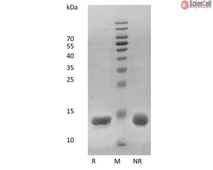 Recombinant Human Interleukin-3