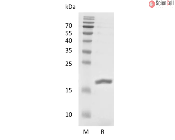 Recombinant Human Leukemia Inhibitory Factor