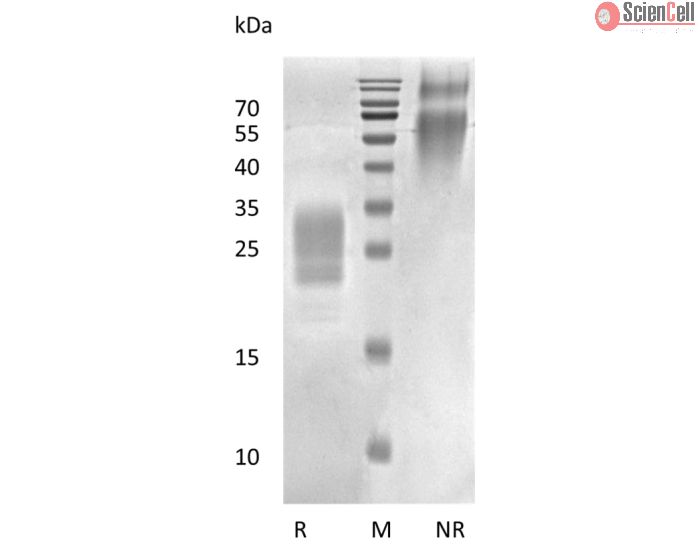 Recombinant Human Placental Growth Hormone