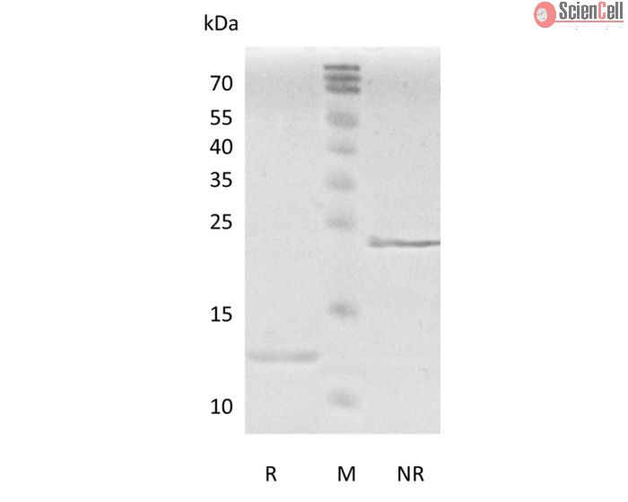 Recombinant Human Transforming Growth Factor-β2