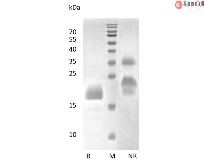 Recombinant Human Vascular Endothelial Growth Factor C