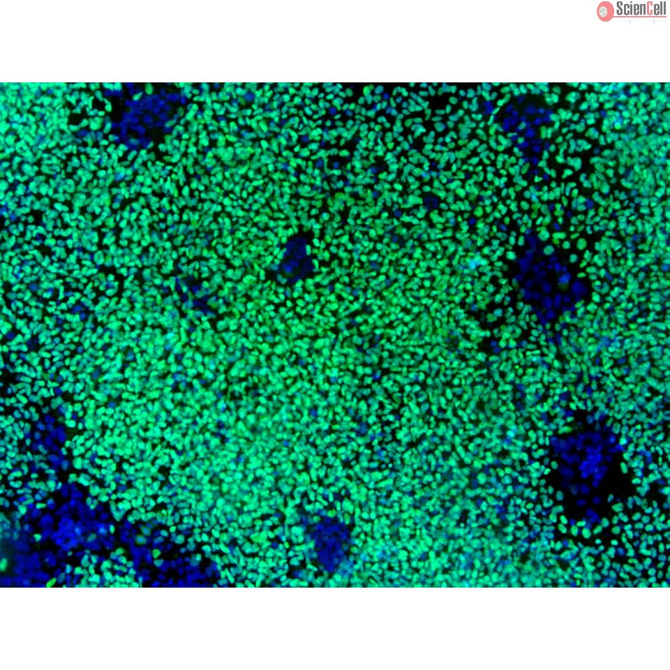 Human Induced Pluripotent Stem Cell-derived Neural Crest Cells...