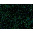 人多能干细胞衍生星形胶质细胞（H9-A）- S100β免疫染色，100x。