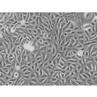 人泌尿上皮细胞（HUC） - 相差显微图，200倍放大。