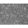 人类支气管成纤维细胞 (HBF) - 相差显微镜，200倍