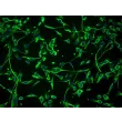 人类施旺细胞 (HSC) - S100-β 免疫染色，200倍。