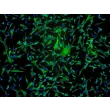 
人类星形胶质细胞-中脑（HA-mb）- GFAP免疫染色，100倍放大。