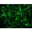 人类星形胶质细胞-海马（HA-h）- GFAP免疫染色，200倍放大。