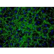 人类毛发生殖基质细胞 (HHGMC) - 纤维连接蛋白免疫染色，200x。