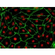 人类肾上腺微血管内皮细胞（HAdMEC）- CD31免疫染色，400倍
