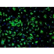 人类肾小球内皮细胞（HRGEC）- 免疫染色，标记 vWF，200倍显微镜放大。
