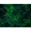 人类脉络丛成纤维细胞 (HCPF) - 免疫染色纤维连接蛋白，100倍。
