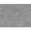 人精囊成纤维细胞（HSVF）- 相差显微镜，100×
