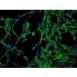 人结膜成纤维细胞（HConF）- 纤连蛋白（Fibronectin）免疫染色，200×