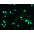 人肝巨噬细胞（HHMa）– F4/80因子免疫染色，100倍
