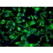 人肾近曲小管上皮细胞（HRPTEpiC） - CK-18 免疫染色，200 倍放大。