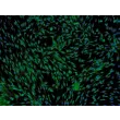 人脂肪间充质干细胞（HMSC-ad）—— CD73 免疫染色，100×。