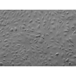 人脑微血管内皮细胞（HBMEC） - 浮雕相差显微镜, 200倍。