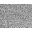 心房心脏成纤维细胞（HCF-aa）- 相差显微镜（Phase contrast），200 倍。
