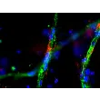 Day 9 post-embedding: Endothelial cells stained with VWF (green) and pericytes stained with NG2 (red), 400x
