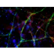 Day 9 post-embedding: Endothelial cells stained with VWF (green) and pericytes stained with NG2 (red), 200x
