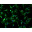 Bovine Iris Pigment Epithelial Cells (BIPEpiC)-Immunostaining for CK-18, 200X