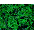 CD1 小鼠中脑星形胶质细胞（MA-mb）— GFAP 免疫荧光染色图像，100 倍放大