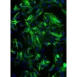 小鼠脑干星形胶质细胞（MA-bs）— GFAP 免疫荧光染色图像，200 倍放大

