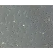 HiPSC-Derived Endothelial Cells (HiPSC-EC) - Phase contrast, 100x
