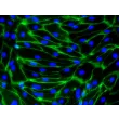 HiPSC-Derived Endothelial Cells (HiPSC-EC) -
Immunostaining for CD31, 200x
