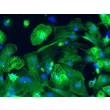 HPSC-Derived Cardiomyocytes (H9-CM) -  Immunostaining for α-actinin, 200x