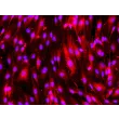 hPSC-Derived Endothelial Cells (hPSC-EC) -
Immunostaining for vWF, 200x
