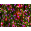 hPSC-Derived Endothelial Cells (hPSC-EC) -
Immunostaining for CD31 and vWF, 200x
