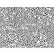 Human Annulus Fibrosus Cells (HAFC) - Phase contrast, 200x.
