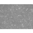 Human Aortic Smooth Muscle Cells (HASMC) - Phase contrast, 100x.