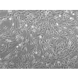 Human Bladder Smooth Muscle Cells (HBdSMC) - Phase contrast, 200x.
