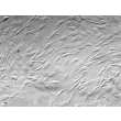 Human Bladder Stromal Fibroblasts (HBdSF) - Relief contrast, 200x.
