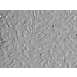 Human_Bone_Marrow-derived Mesenchymal Stem Cells (HMSC-bm) - Relief contrast, 100x.
