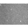 HumanBone Marrow-derived_Mesenchymal_Stem_Cells (HMSC-bm) – Phase contrast, 100x.
