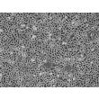 Human Bronchial Epithelial Cells (HBEpiC) - Phase contrast, 100x.
