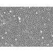Human Bronchial Smooth Muscle Cells (HBSM) - Phase contrast, 200x.
